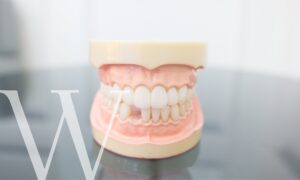 Dental implants can replace missing teeth.